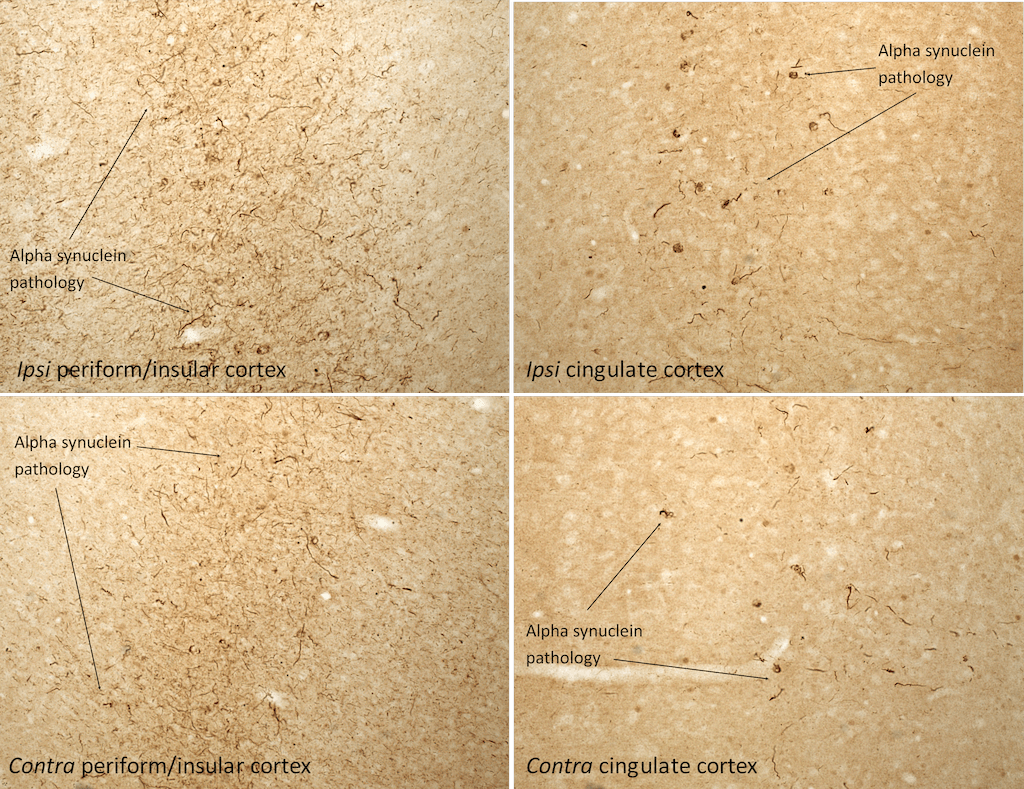 IHC analysis of rat brain injected with Type 1 mouse alpha synuclein PFFs