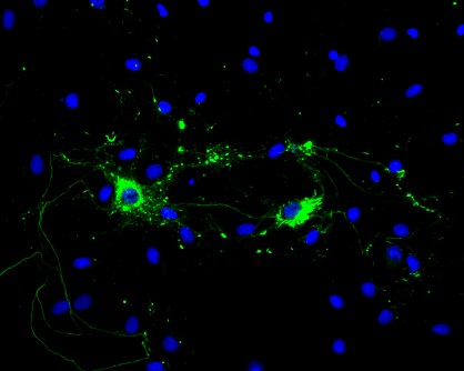 Rat primary hippocampal neurons with Type 1 mouse alpha synuclein PFFs