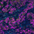 Cell-Proliferation-and-Metastasis-PathPlex®-Panel-(CD3E-Granzyme-B-CD8-alpha-Cytokeratin-Ki-67-SOX10)-min