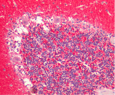 The picture shows Alpha Synuclein Antibody (SMC-800) in human cerebellum