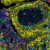 Immunosuppression-PathPlex®-Panel-(CD3E-Cytokeratin-CD8-alpha-CD68-PD-L1-FOXP3)-min