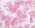 PathPlus™ Cancer ERBB2 / HER2 Antibody LS-B2133
