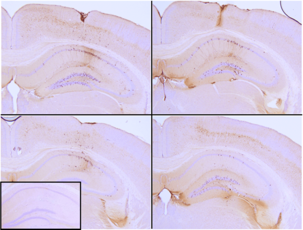 IHC analysis of P301L mouse hippocampus injected
