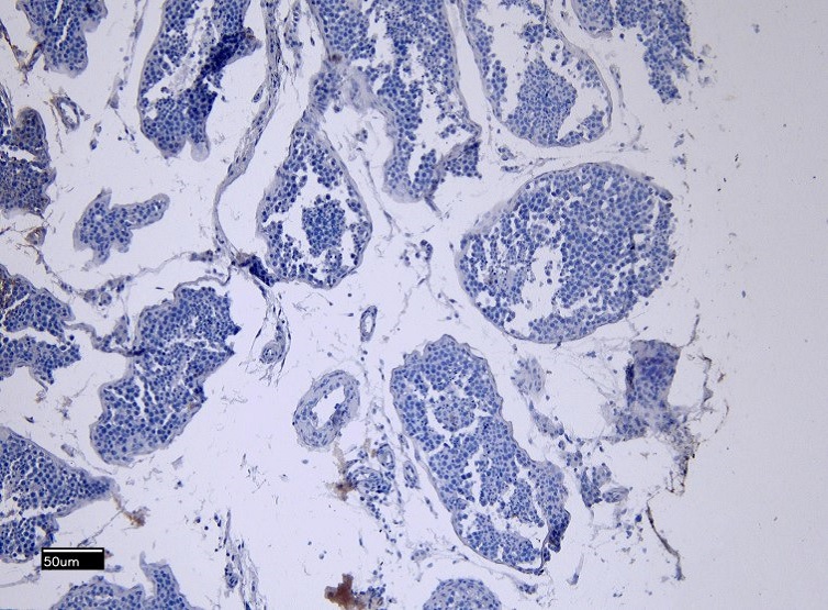 EB13087 Negative Control showing staining of paraffin embedded Human Testis, with no primary antibody.