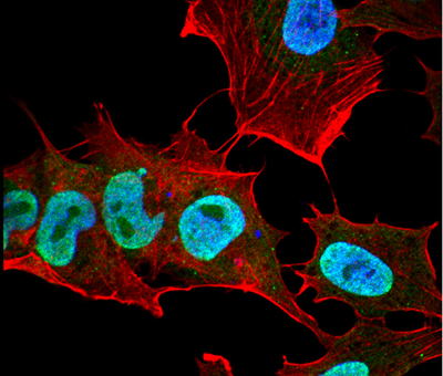 Alpha Synuclein Antibody