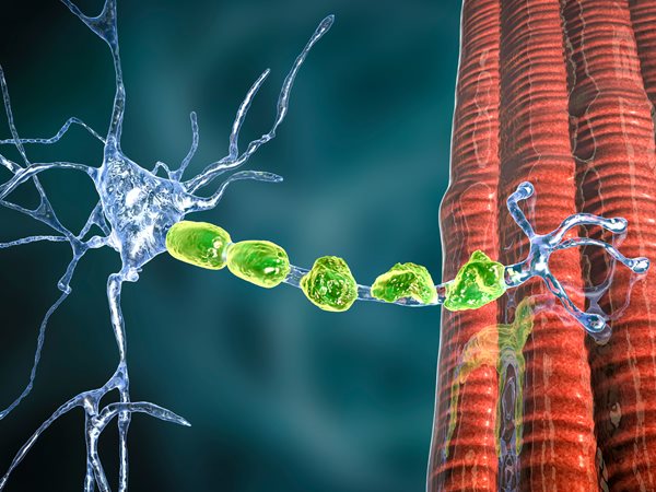 Amyotrophic Lateral Sclerosis