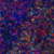 T-Cell-Maturation-PathPlex®-Panel-(CD8-alpha-Cytokeratin-CD45RO-CD4-FOXP3)-min