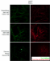 The antibodies below were tested in iPSC-derived cortical neurons with and without the P301L mutation.