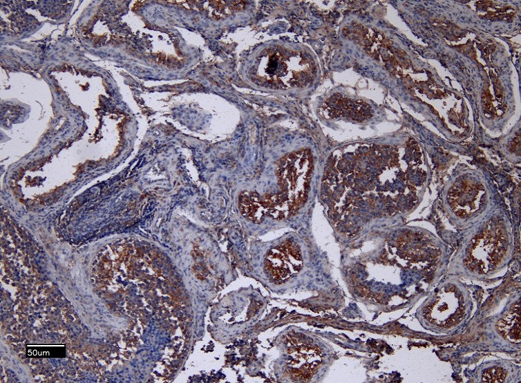 EB13087 (8µg/ml) staining of paraffin embed Human Testis. Heat induced antigen retrieval with citrate buffer pH 6, HRP-staining.