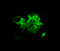 Amyloid-beta – in der Größe angepasst