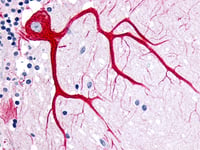PathPlus-Neuro-Antikörper