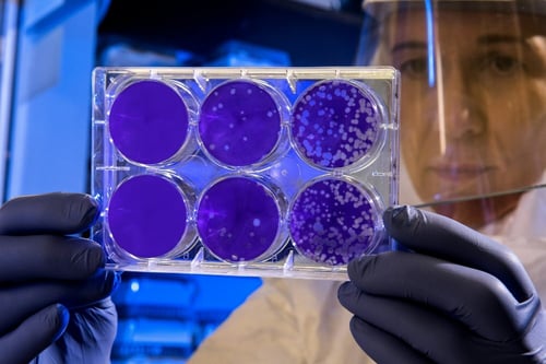 dna-3
