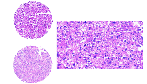 mymabs-Lebergewebe-Mikroarray