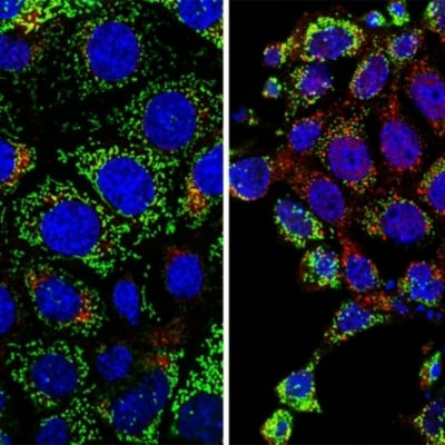 TDP-43