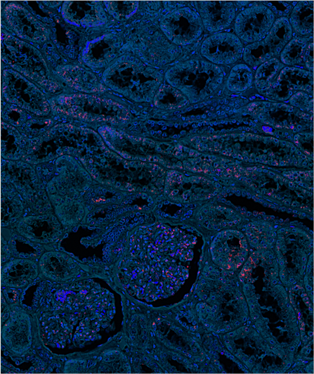 What is Proximity Ligation Assay?