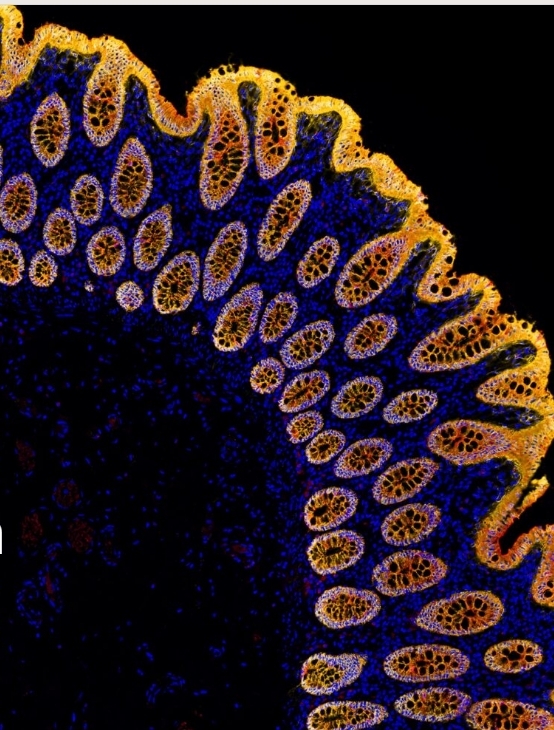 Getting closer to co-localised proteins!