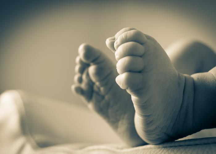 Newborn Jaundice (Neonatal Jaundice)